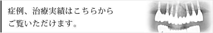 症例、治療実績はこちらからご覧いただけます。