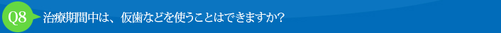 Q8:治療期間中は、仮歯などを使うことはできますか？