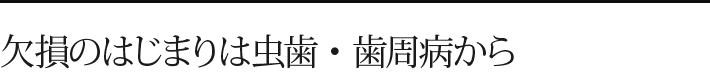 欠損のはじまりは虫歯・歯周病から